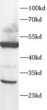 DMC1 Antibody