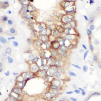 ENPP2 Rabbit Polyclonal Antibody