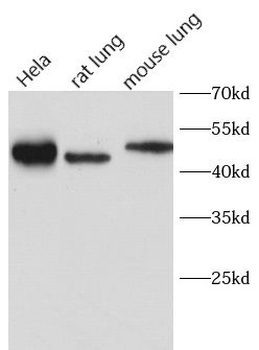CAV1 Rabbit Polyclonal Antibody