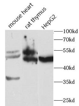 FGFR1 Rabbit Polyclonal Antibody