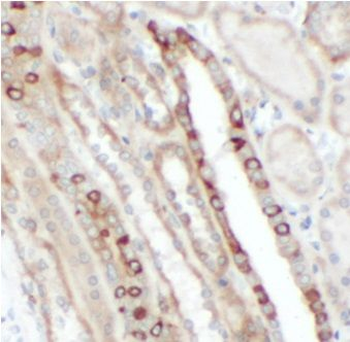 FGFR1 Rabbit Polyclonal Antibody