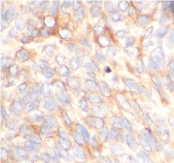 GFPT1 Antibody