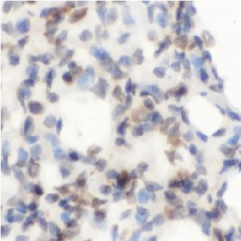 AGER Rabbit Polyclonal Antibody
