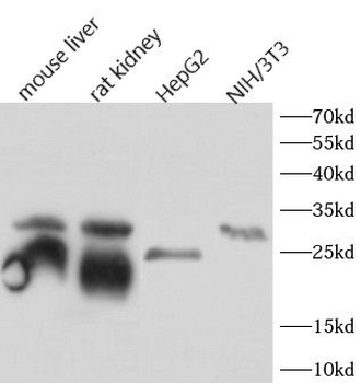 CTSB Rabbit Polyclonal Antibody