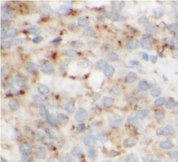 CTSB Rabbit Polyclonal Antibody