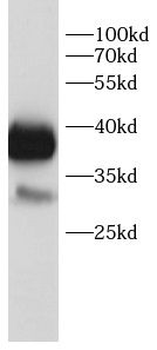 CAMK2D Rabbit Polyclonal Antibody