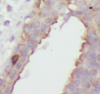 CAMK2D Rabbit Polyclonal Antibody