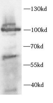 CHM Antibody