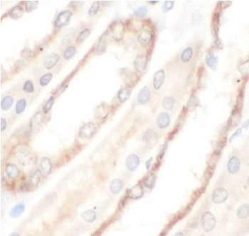 UTRN Rabbit Polyclonal Antibody