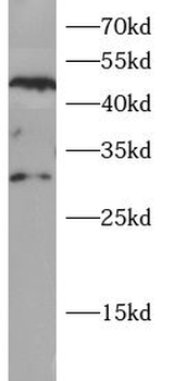 NAT2 Antibody