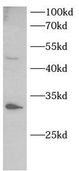 UCP2 Antibody