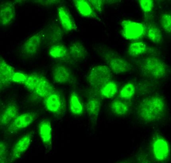 SIRT1 Rabbit Polyclonal Antibody