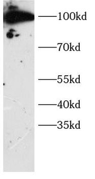 DTL Antibody
