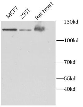 HK1 Rabbit Polyclonal Antibody