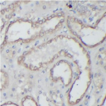HK1 Rabbit Polyclonal Antibody