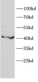 A1BG Rabbit Polyclonal Antibody