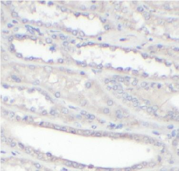 A1BG Rabbit Polyclonal Antibody