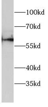 SGK1 Rabbit Polyclonal Antibody