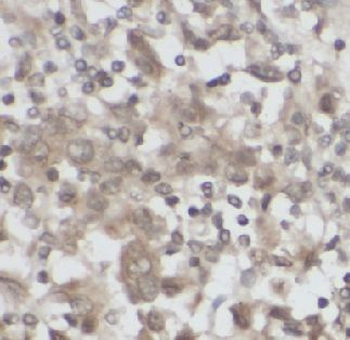 SGK1 Rabbit Polyclonal Antibody