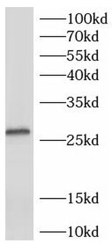 CITED2 Antibody