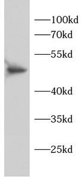 NFKB1 Rabbit Polyclonal Antibody