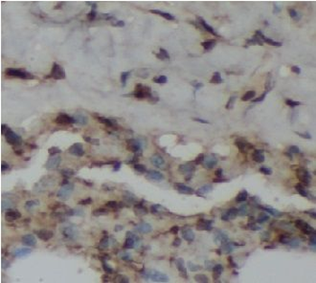 NFKB1 Rabbit Polyclonal Antibody