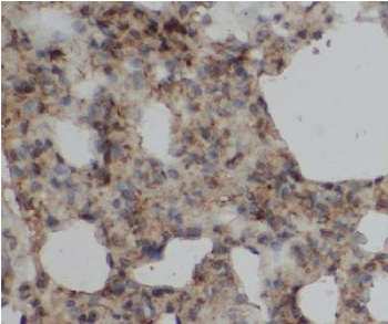 RPS6KA5 Rabbit Polyclonal Antibody