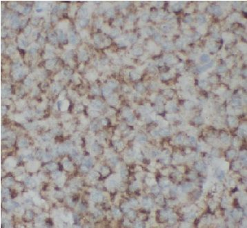 ITCH Rabbit Polyclonal Antibody