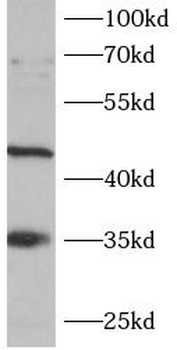 KITLG Rabbit Polyclonal Antibody