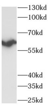 RPS6KB2 Rabbit Polyclonal Antibody