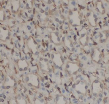 RPS6KB2 Rabbit Polyclonal Antibody