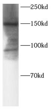 SOS2 Antibody