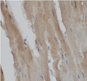 GRB2 Rabbit Polyclonal Antibody