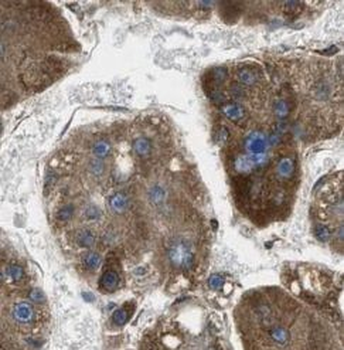 BCL2L2 Rabbit Polyclonal Antibody