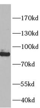 SLC26A3 Antibody