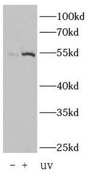 Phospho-p53 (Ser15) Antibody
