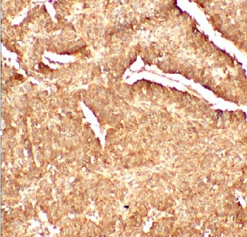 LAMP1 Mouse Monoclonal Antibody
