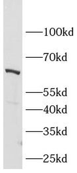 OPRM1 Rabbit Polyclonal Antibody