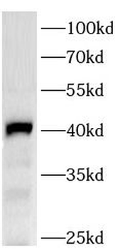 RFP Antibody