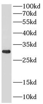 METTL27 Rabbit Polyclonal Antibody