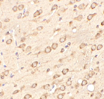 METTL27 Rabbit Polyclonal Antibody
