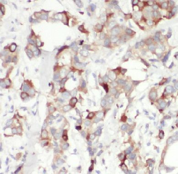 BECN1 Mouse Monoclonal Antibody
