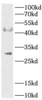 RPUSD4 Antibody
