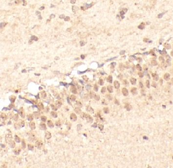 CDKN1C Rabbit Polyclonal Antibody