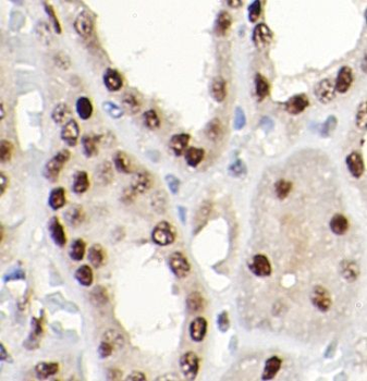 DNMT3B Rabbit Polyclonal Antibody