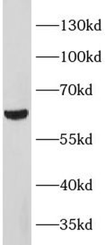 METTL14 Antibody