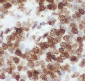 GATA3 Mouse Monoclonal Antibody