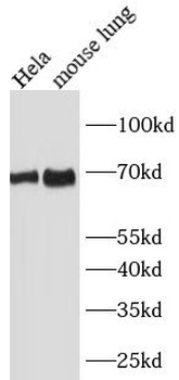 SLC1A5 Antibody