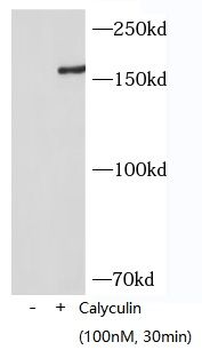 Phospho-PERK(Thr982) Antibody