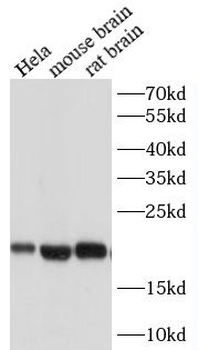 SOD1 Mouse Monoclonal Antibody